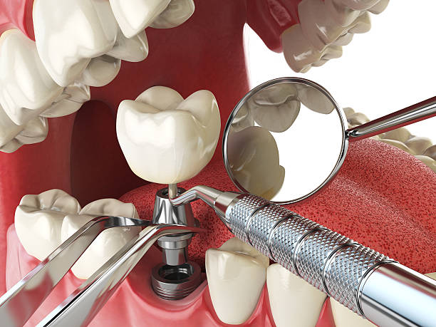 Best Holiday Emergency Dentist in Albemarle, NC